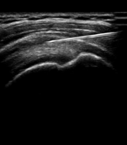 The BIOS Orthopedic Institute